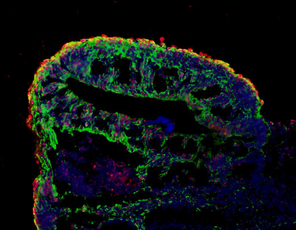 Cerebral Organoid