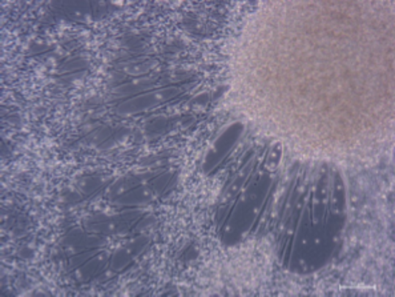 Enteric Neurons