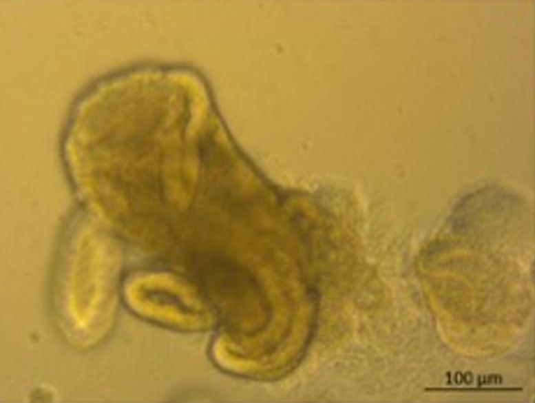 Intestinal Organoid